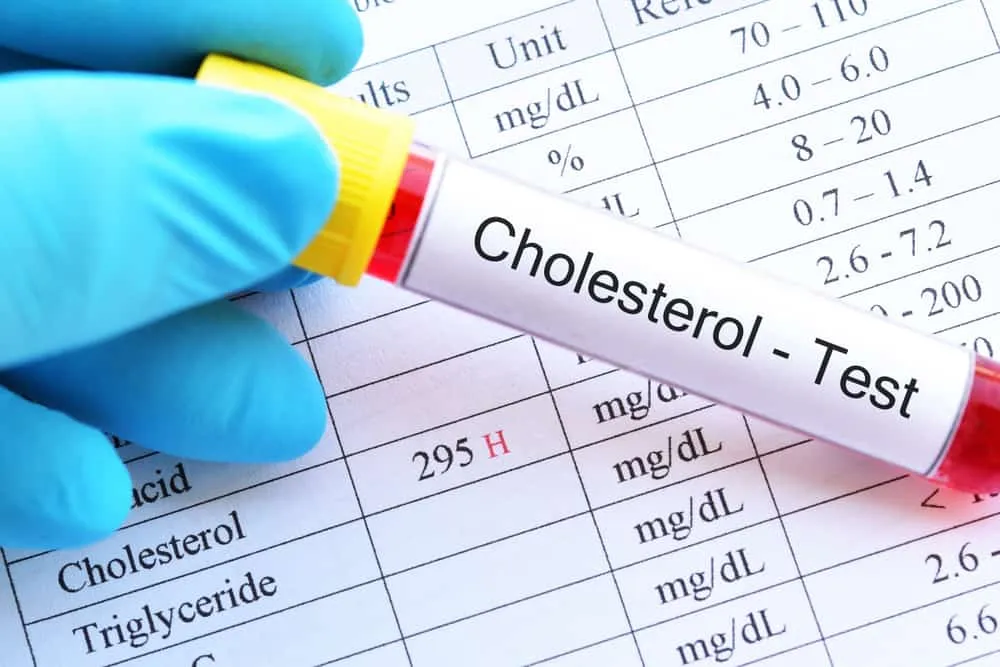 cholesterol là gì?
