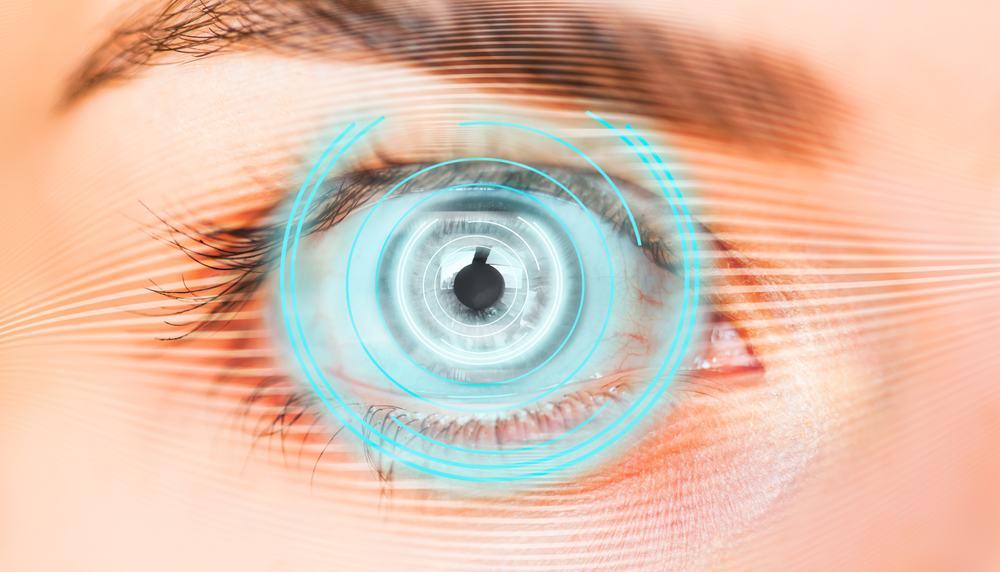 quy trình mổ ReLEx SMILE