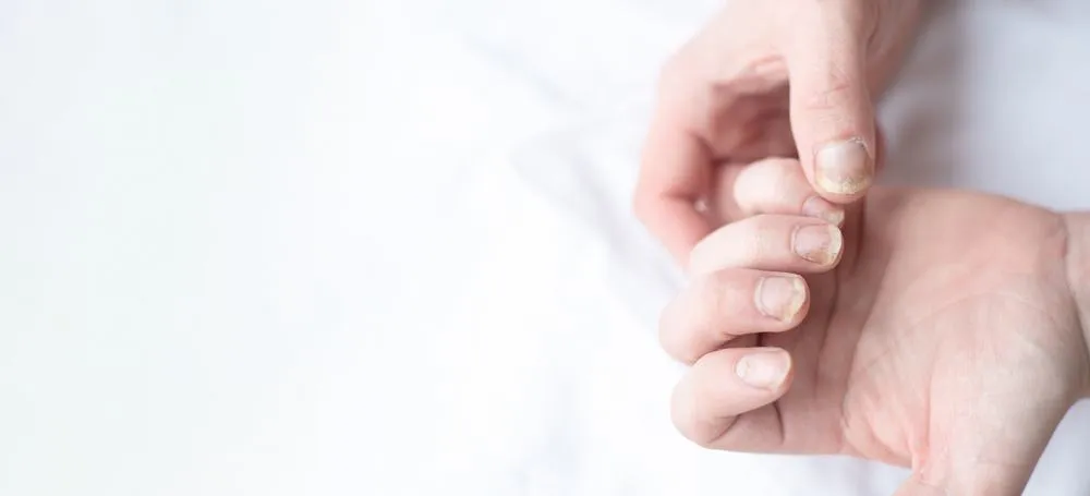 thuốc trị nấm móng tay