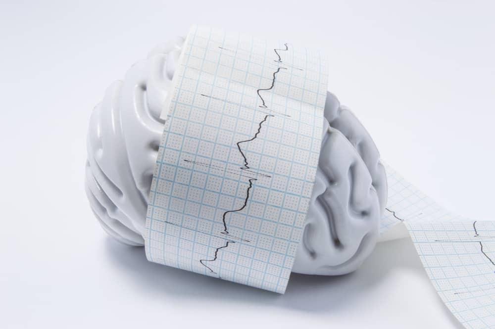 chẩn đoán u màng não