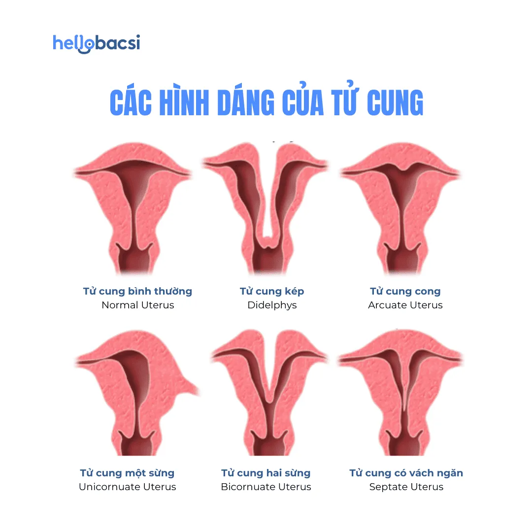 Cấu tạo tử cung