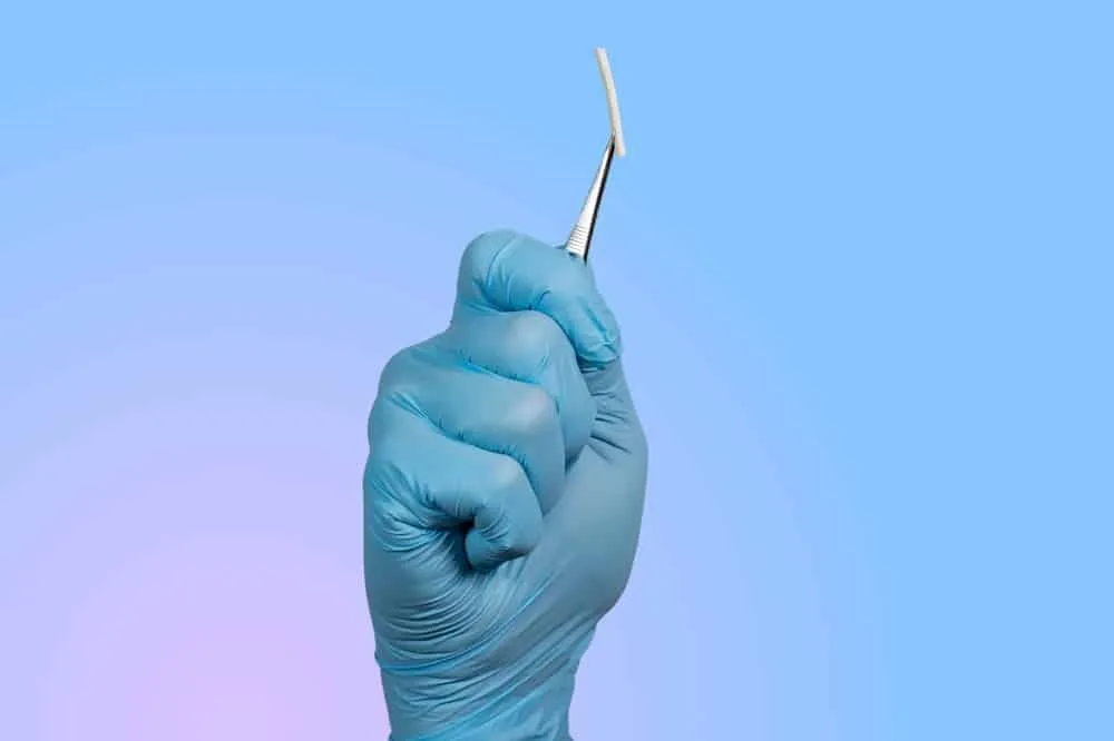 Tháo que tránh thai khi nào