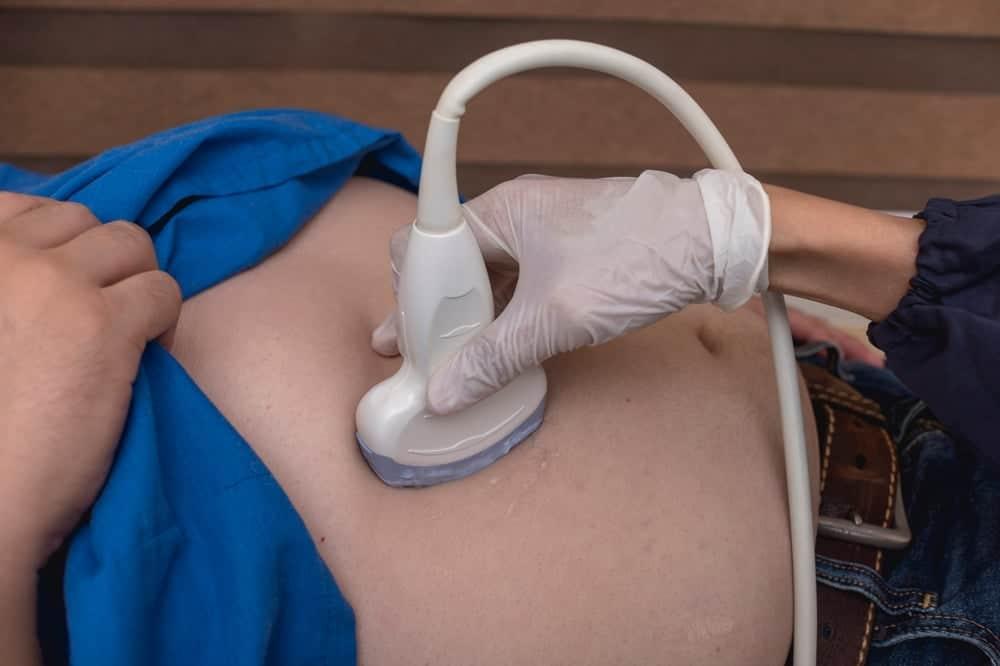 chẩn đoán gan nhiễm mỡ độ 2