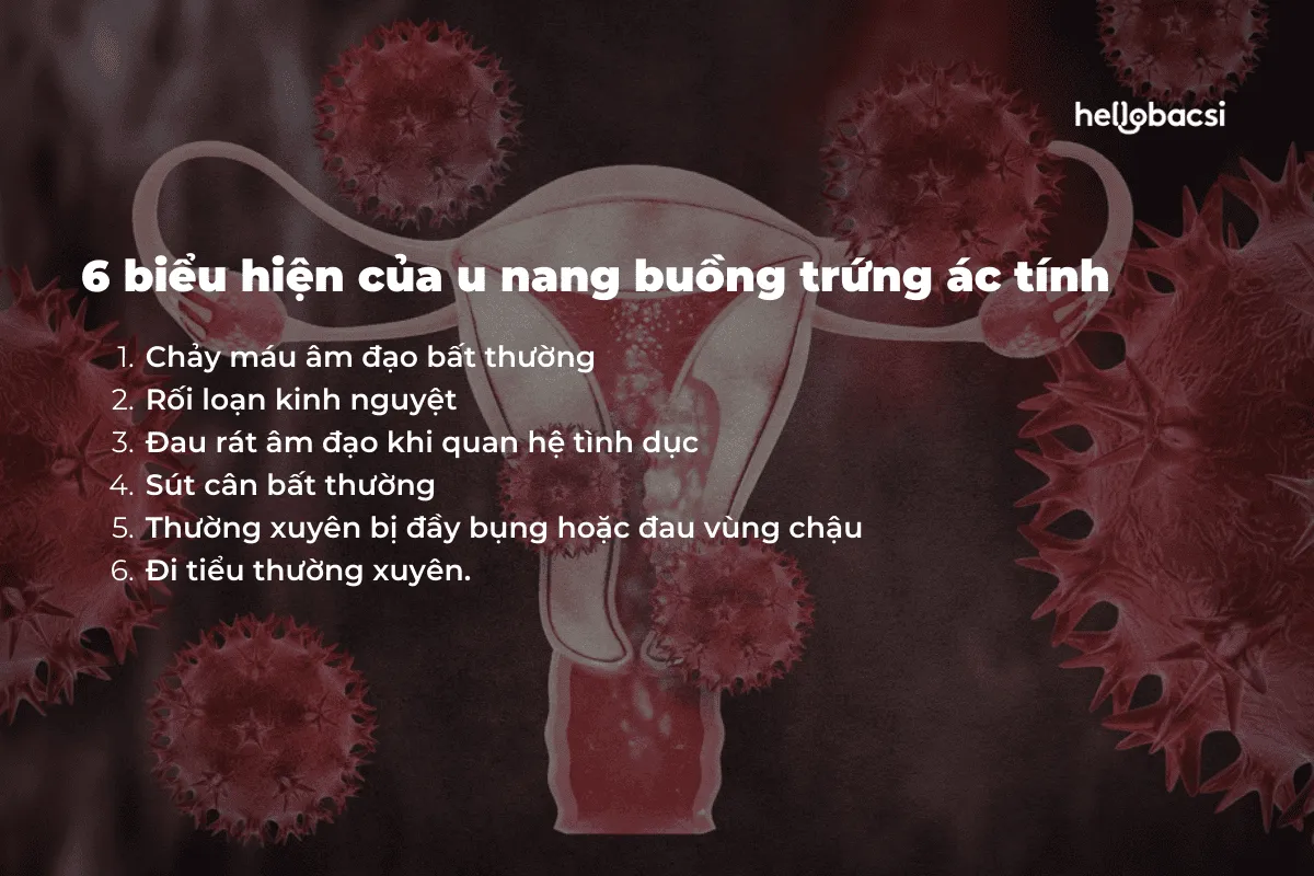 Các khối u phát triển lớn dần khiến người bệnh đi tiểu nhiều lần.