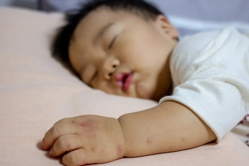 trẻ bị tay chân miệng giật mình khi ngủ