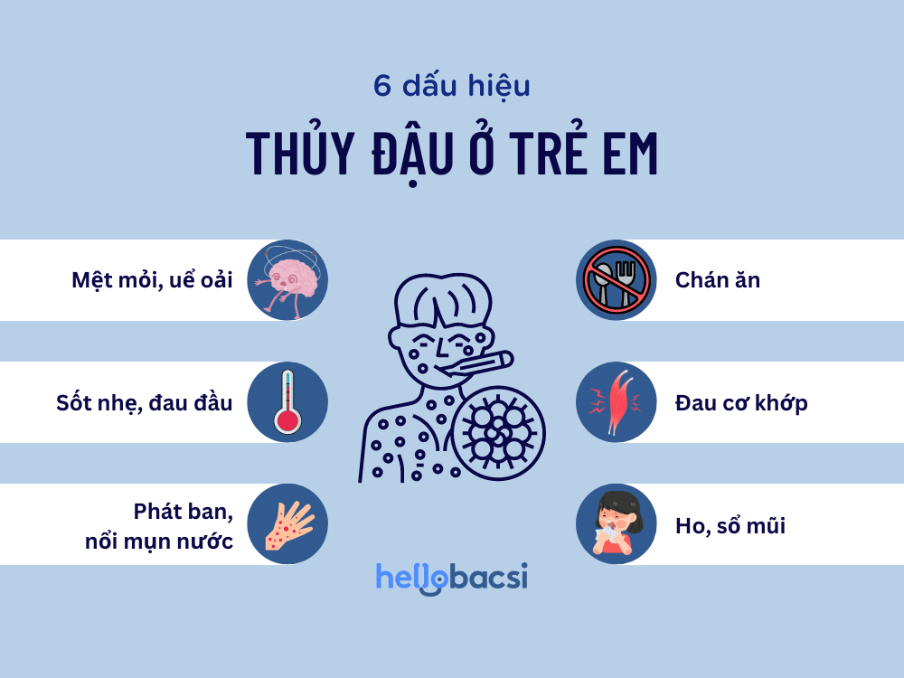 Triệu chứng thủy đậu ở trẻ em