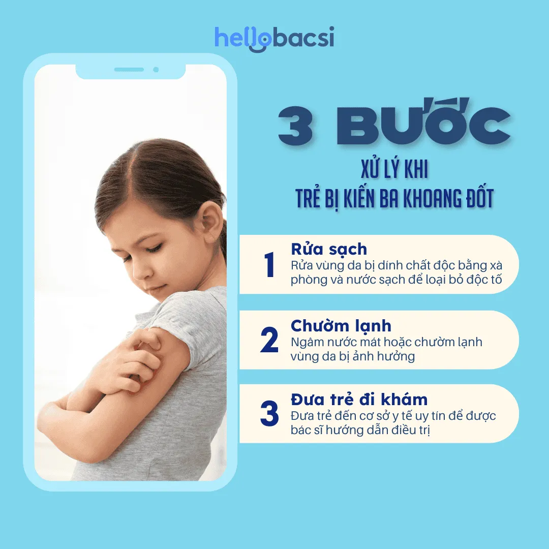 Cách xử lý khi phát hiện bé bị kiến ba khoang cắn