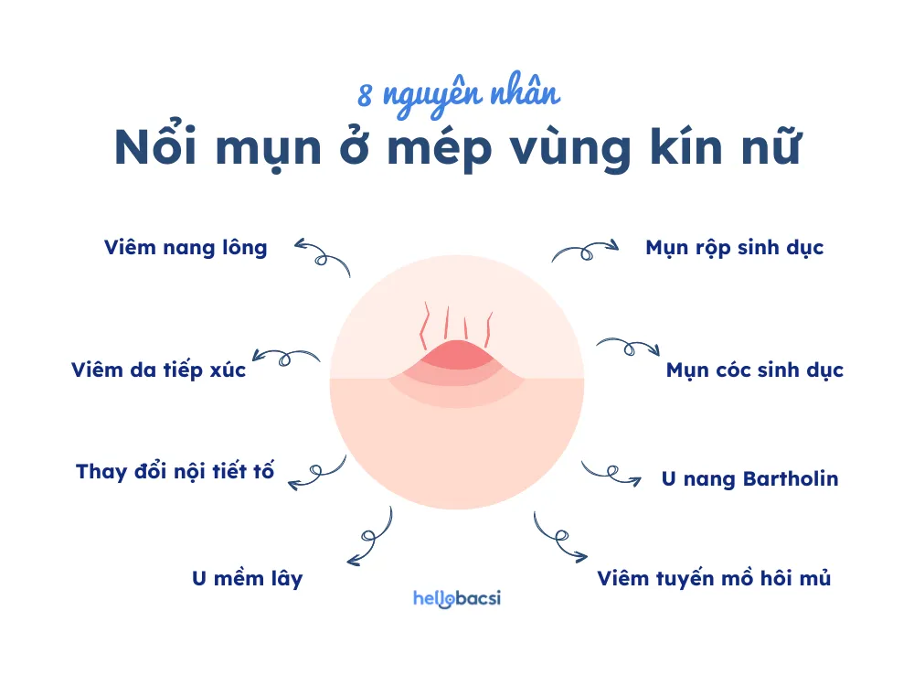 Nổi mụn ở mép vùng kín nữ