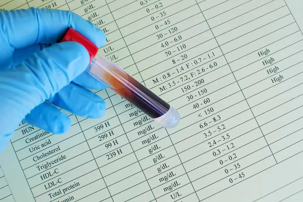 kết quả định lượng HDL-C