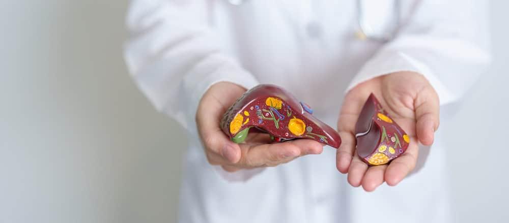 Viêm gan B cấp tính có chữa được không?