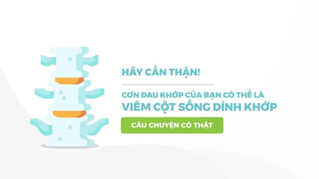 Hãy cẩn thận! Cơn đau khớp của bạn có thể là viêm cột sống dính khớp