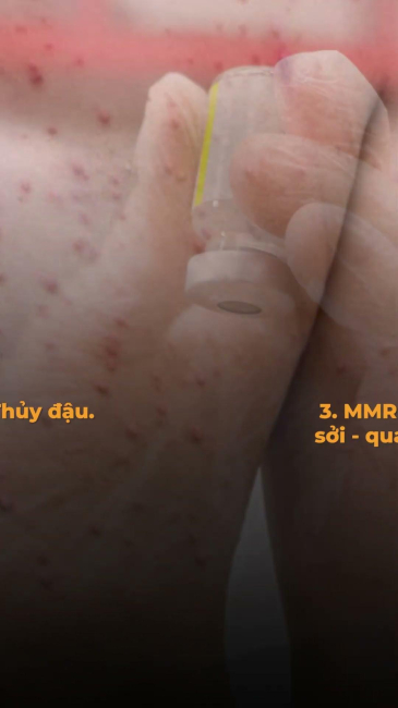 5 loại vacxin cô dâu nhất định phải tiêm trước khi cưới