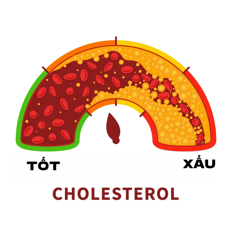 Chỉ số LDL-Cholesterol