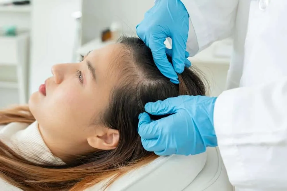 Cách giảm rụng tóc sau sinh