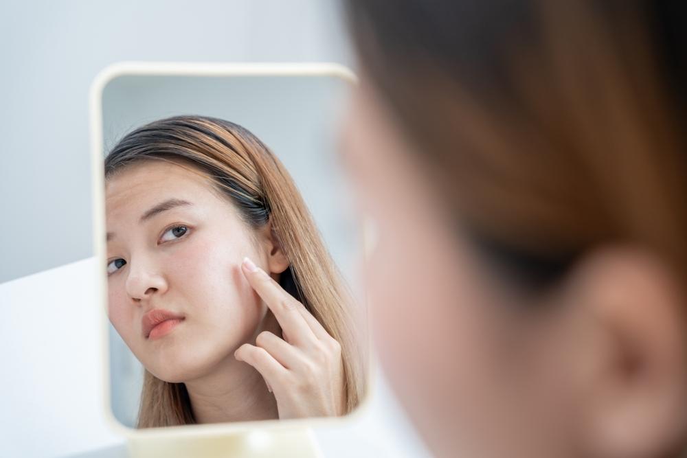 Dấu hiệu da cần được cấp ẩm