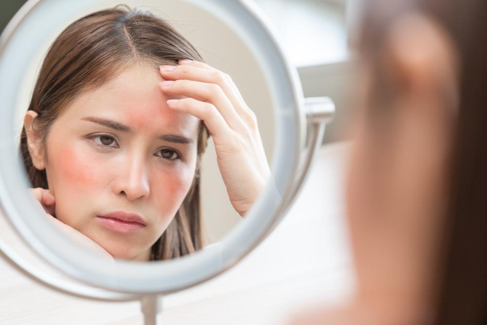 danhạy cảm là do dị ứng