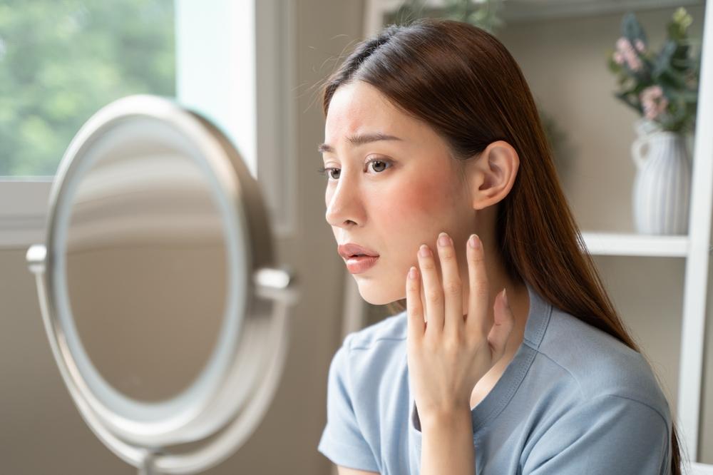 dấu hiệu nhận biết da nhạy cảm 