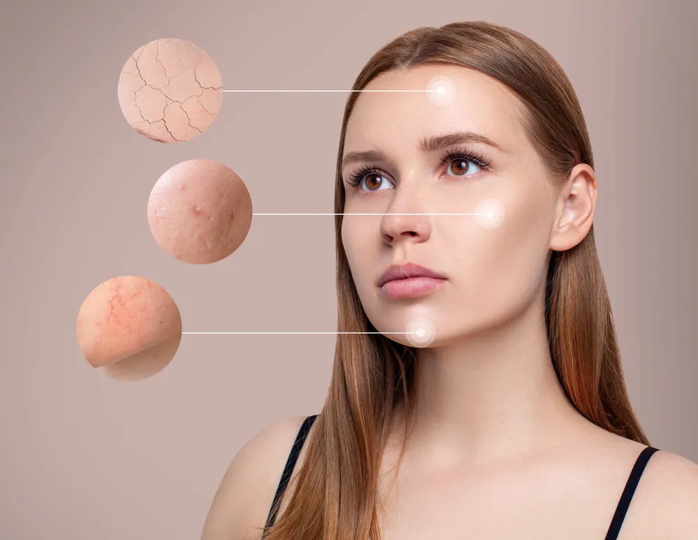 thời điểm vàng làm đẹp sau sinh