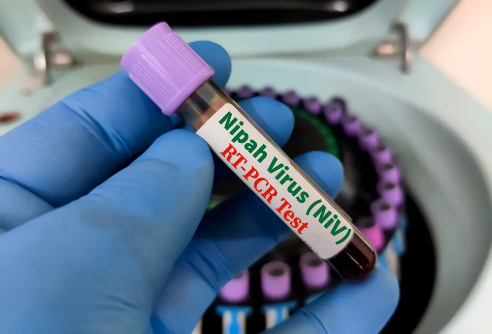 Virus Nipah