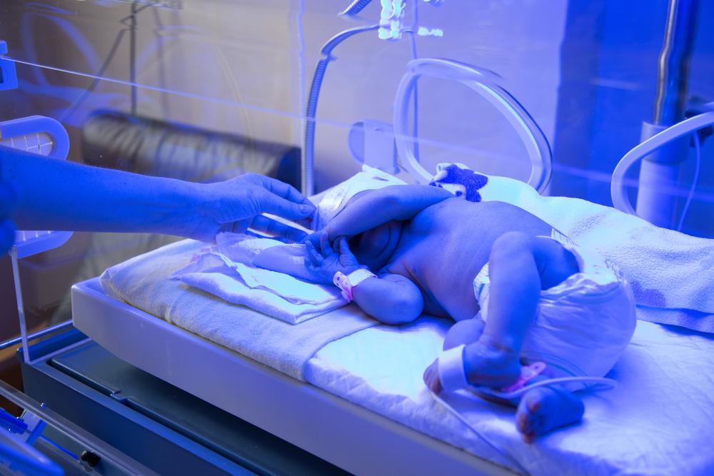 Vàng da ở trẻ sơ sinh có nguy hiểm không